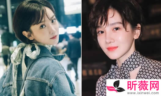 陈小纭早期照片：陈小纭八卦整容了吗