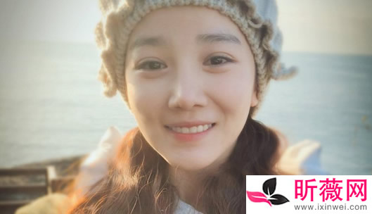 陈小纭早期照片：陈小纭八卦整容了吗