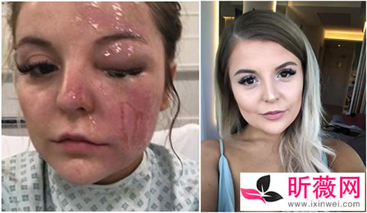 微波炉煮蛋遭爆炸什么情况:究竟发生了始末详情揭晓 微波炉煮蛋遭爆炸什么情况:究竟发生了始末详情揭晓