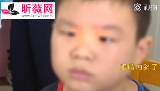 9岁男孩玩手机变成斗鸡眼：一天能玩上10小时酿悲剧