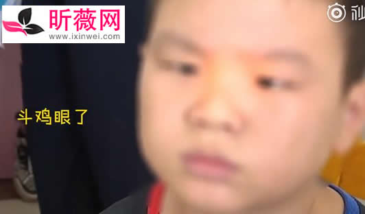 9岁男孩玩手机变成斗鸡眼：一天能玩上10小时酿悲剧