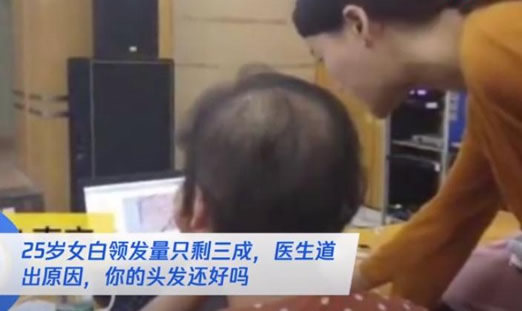女白领发量剩3成什么情况:医生揭原因及有效防脱发 女白领发量剩3成什么情况:医生揭原因及有效防脱发