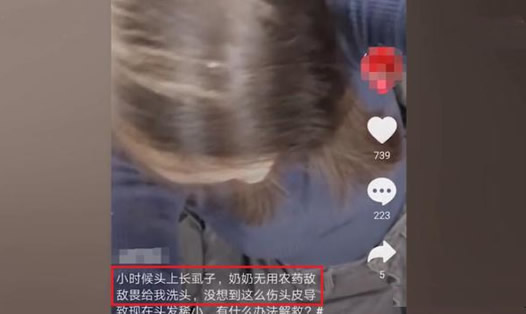 大妈用敌敌畏洗头怎么回事：事件始末详情及结果