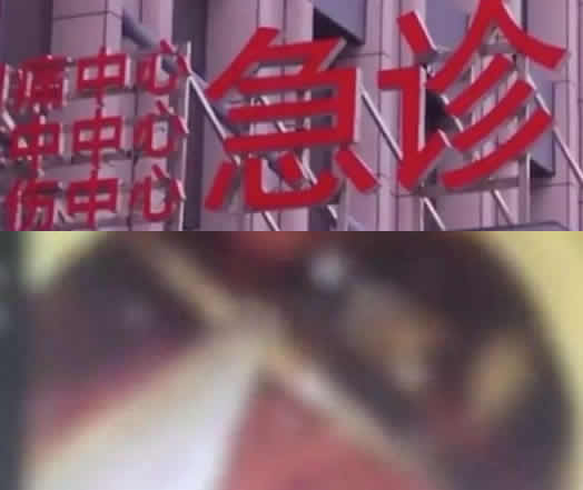 女孩醉酒吞下汤勺什么情况:醉酒女孩的可怕你需要了解 女孩醉酒吞下汤勺什么情况:醉酒女孩的可怕你需要了解