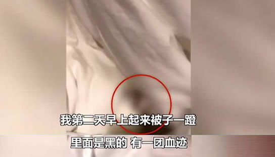 醒来发现被子有血什么情况:关于一摊血到底怎么回事 醒来发现被子有血什么情况:关于一摊血到底怎么回事