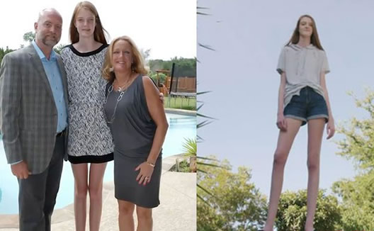 16岁女生逆天长腿怎么回事:腿长135厘米的原因是什么 16岁女生逆天长腿怎么回事:腿长135厘米的原因是什么