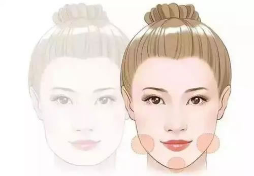 千元玻尿酸成本19：这背后到底是怎么回事