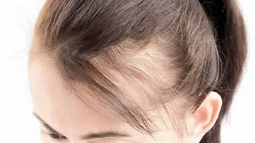 女人掉头发是什么原因老掉头的各种原因汇总