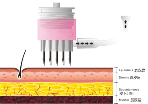 美容课堂 初曦水光究竟是什么? 美容课堂 初曦水光究竟是什么?