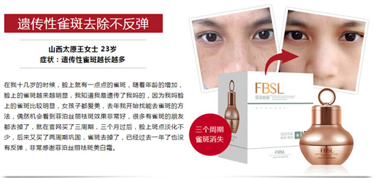 祛斑最好的方法目前最有效的 让您拥有令人嫉妒的肌肤 祛斑最好的方法目前最有效的 让您拥有令人嫉妒的肌肤