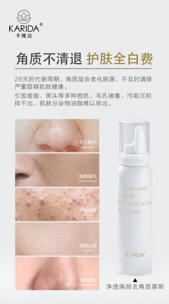 卡维达:去角质很重要,乱用的后果是毁皮肤 卡维达:去角质很重要,乱用的后果是毁皮肤