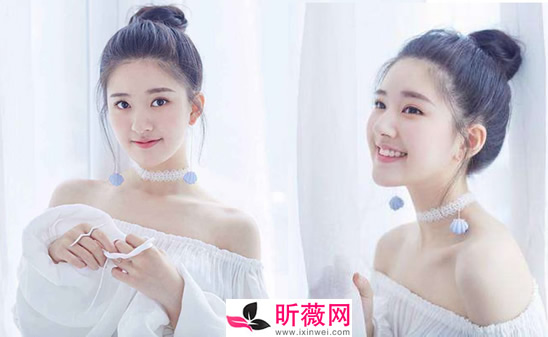 赵露思走红原因曝光 赵露思被质疑整容是怎么回事