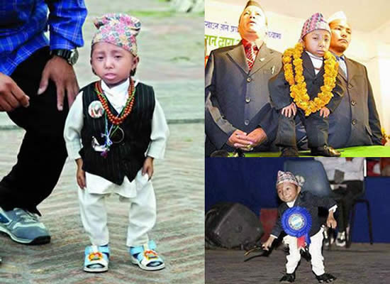 14岁少年身高50厘米 80岁老人和72岁妻子生子