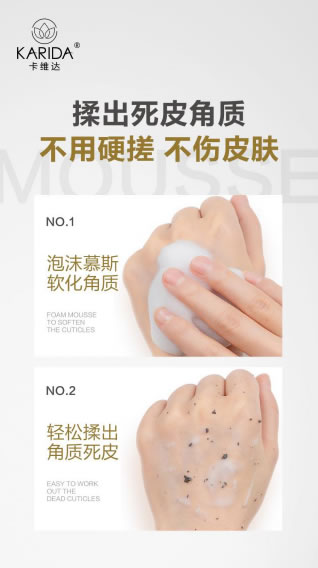 卡维达:黑头多、毛孔大,还满脸闭口?你该去角质了 卡维达:黑头多、毛孔大,还满脸闭口?你该去角质了