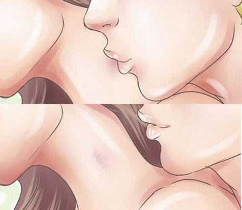 草莓印怎么快速消除 一大泼草莓吻痕图片
