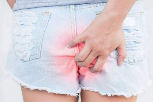 女性痔疮治疗方法有哪些？女性痔疮怎么治？