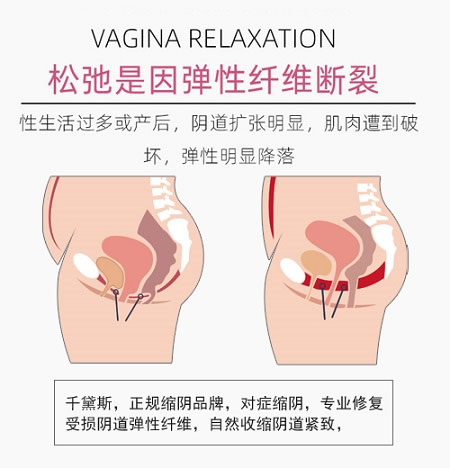 缩阴的有效方法，学会了少走弯路！