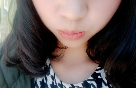 洗面奶能祛痘痘吗 痘痘反复的原因有哪些