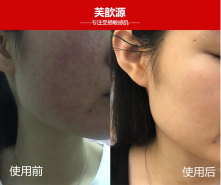 芙歆源谁用过?解读芙歆源到底有没有效果