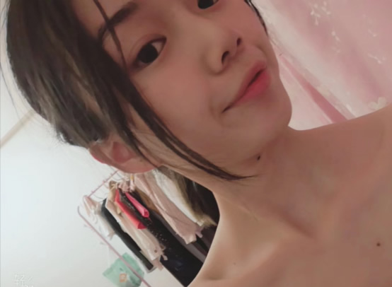 怎么快速祛斑?好用的祛斑方法亲身祛斑经验分享 怎么快速祛斑?好用的祛斑方法亲身祛斑经验分享