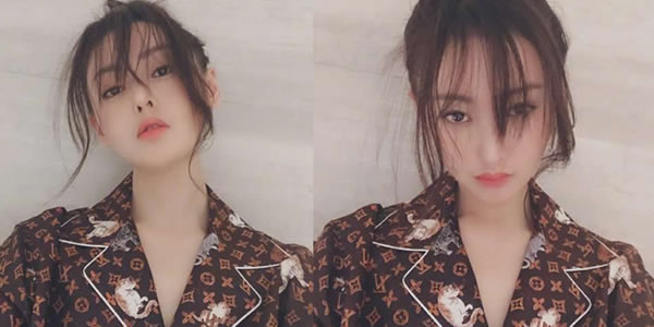 张天爱旧照曝光整容了吗