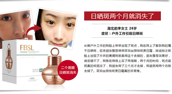 DIY祛斑方法有哪些？有效祛斑的祛斑霜推荐