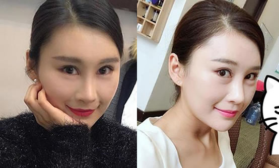 眼部细纹怎么办？做好护理三个步骤轻松去眼纹