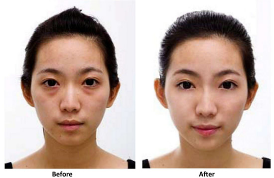 如何预防眼角皱纹和消除?好习惯+护理眼霜事半功倍 如何预防眼角皱纹和消除?好习惯+护理眼霜事半功倍