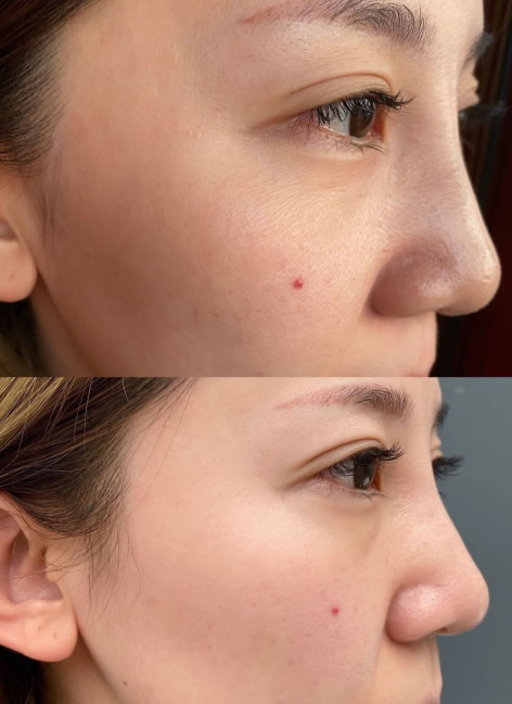 护肤攻略 Amilera驻颜修护安瓶 敏肌可用的抗皱宝藏单品