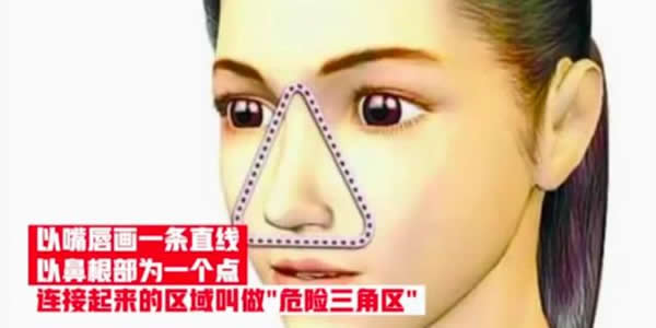 女孩挤痘引发颅内感染 挤痘痘的危害须知