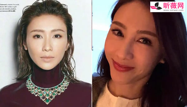 黎姿整容了吗 黎姿整容了吗