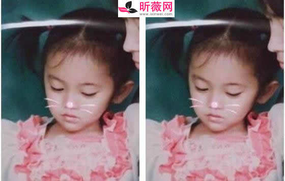 鞠婧祎有没有整容呀！鞠婧祎资料及男朋友是谁