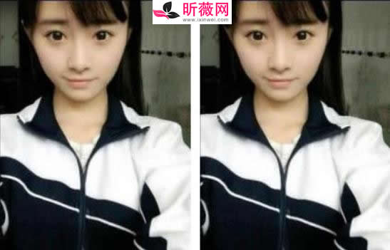 鞠婧祎有没有整容呀！鞠婧祎资料及男朋友是谁