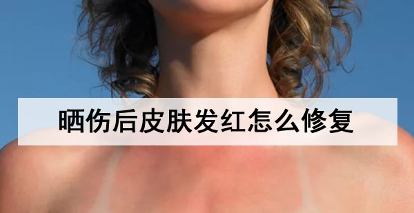 晒伤后皮肤发红怎么修复 教你5个小妙招快速改善